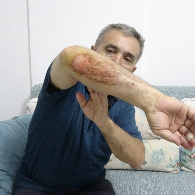 Otizmli oğluyla doğa gezisi sırasında sahipli köpeklerin saldırısına uğradı...