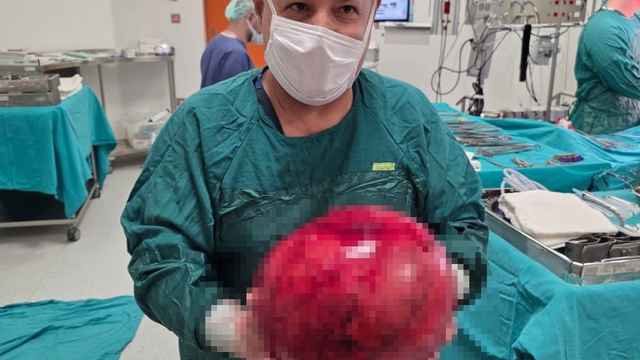 Doktorlar gözlerine inanamadı: 1,5 yıl ertelediği ameliyatta karnından dev kitle çıktı
Ameliyat korkusu az kalsın canından ediyordu
Karnından 6,5 kiloluk tümör çıkarıldı
"Meslek hayatımda ilk defa bu kadar büyüklükte böbrek kitlesiyle karşılaştım"