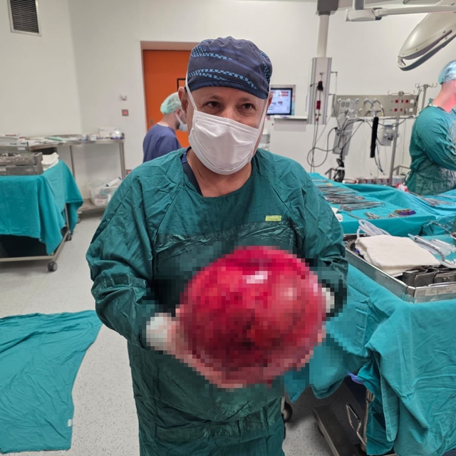 Doktorlar gözlerine inanamadı: 1,5 yıl ertelediği ameliyatta karnından dev...