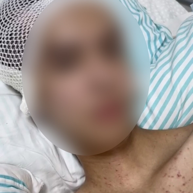 Tacize direndiği iddiasıyla başından vurulan çocuk felç kaldı