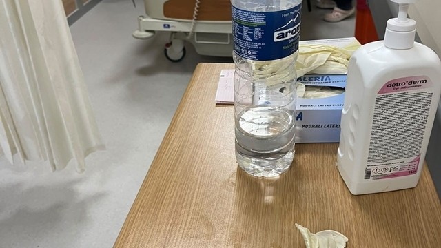 Vücudundan 5 günde 62 parça uyuşturucu çıktı