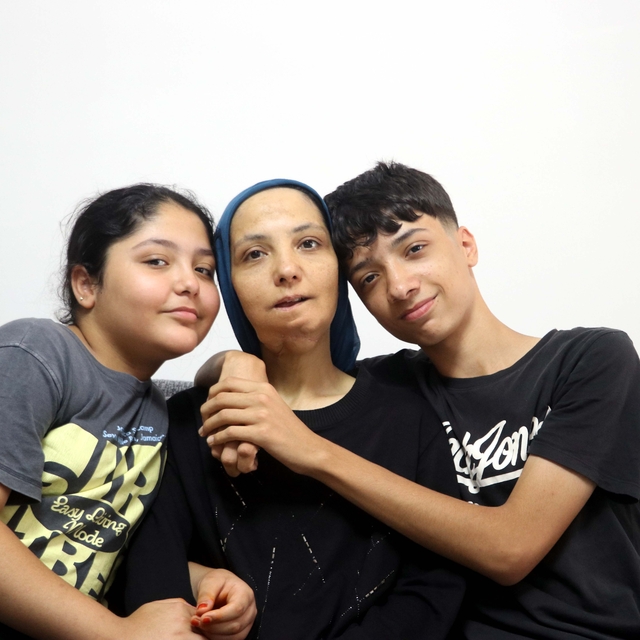 3 çocuk annesi, 11 yılda 35 ameliyat geçirdi; son ameliyatı olmazsa dili al...