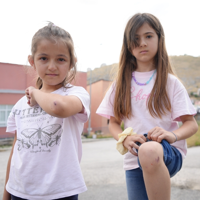 Bayburt'a tatile gelen iki kuzen köpeklerden kaçarken yaralandı