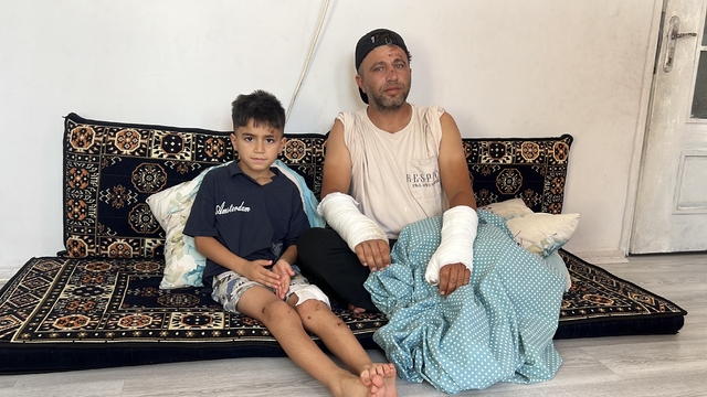 Otomobilin ezip kaçtığı aile dehşet anlarını anlattı: "O an hayatın bittiğini düşündüm"
Baba Adem Aksaç:
"İki kolum alçıda, vücudumuzun çeşitli yerlerinde yaralar var"
"Eşimin ve çocuklarımın da yaraları ve kırıkları bulunuyor, en ağır olan ise yaşadığımız psikolojik travma"