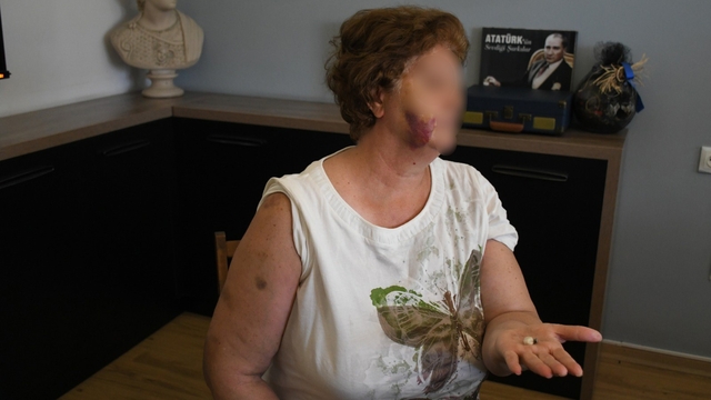 Kuşadası'nda ev kavgası kanlı bitti: Anne ve iki çocuğu bıçaklandı
Anne, kızı ile oğlunu bıçaklayıp darbeden baba-oğul tutuklandı