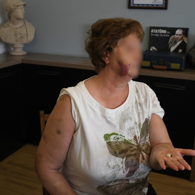 Kuşadası'nda ev kavgası kanlı bitti: Anne ve iki çocuğu bıçaklandı
Anne, kı...
