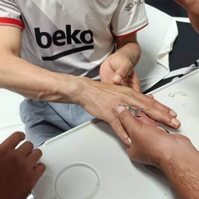Antakya'da vatandaşın parmağına sıkışan yüzüğü itfaiye çıkardı