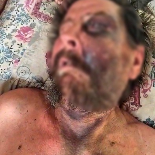 "Abimin cenazesine neden gelmedin" diyerek dövüp ölüme terk etmişler
Darbed...