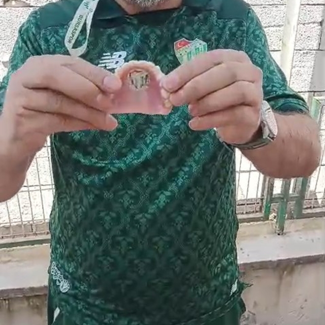 Bursaspor'un fanatik taraftarı takma dişinin damağına da kulüp amblemi yapt...