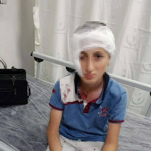 11 yaşındaki çocuğa köpek saldırısında 1,2 milyon TL tazminat kararı