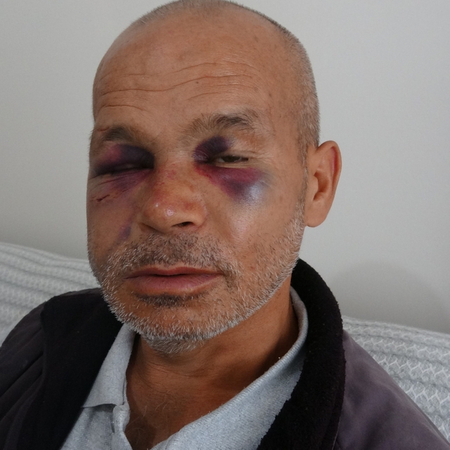 Engelli adamı darbeden şüpheli serbest bırakıldı