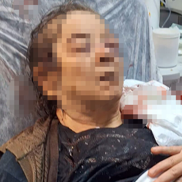 Evde otururken tavandan kopan moloz yığını altında kalan kadın yaralandı