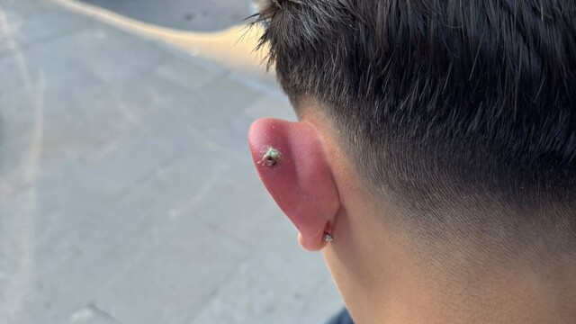Bursa'da piercing olayında yeni gelişme
İlçe Sağlık Müdürlüğü ekipleri harekete geçti