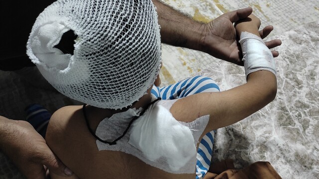 Şanlıurfa'da sahipsiz köpeklerin saldırısına uğrayan çocuk yaralandı