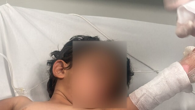 Şırnak'ta 3 yaşındaki kızın üzerine kaynar su döküldü