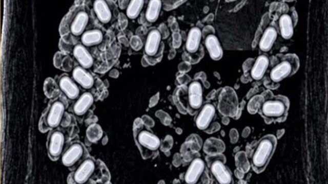 Havalimanında şüpheli yolcunun midesinden 322 gram metamfetamin çıktı