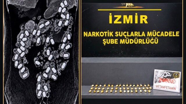Havalimanında yakalandı: Midesinden 47 kapsül uyuşturucu çıktı